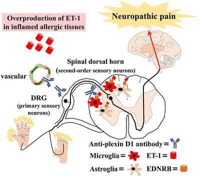 Novel Neuropathic Pain Mechanisms Associated With Allergic Inflammation